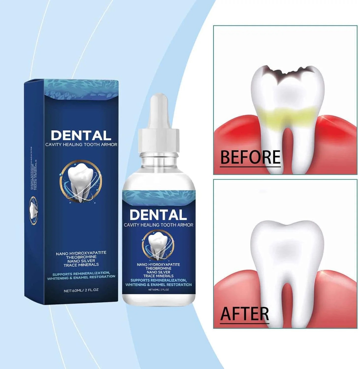 Cavity Healing Tooth Armor Liquid-30ml-1pcs